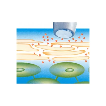 Ultrahangos arckezelés